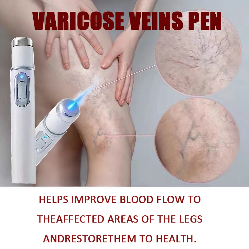 Varicocele Therapy Light Lamp 1