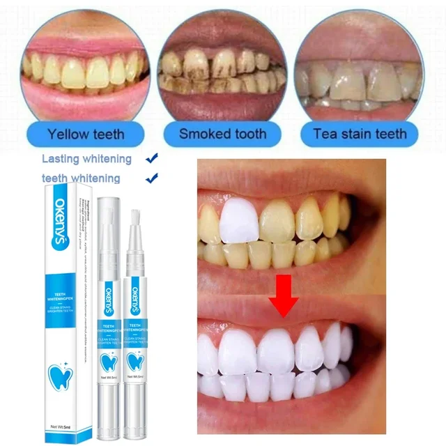 Whitening Tooth Pen Remove Smoke Stains, Coffee, Tea, Freshen Dad Breath, Oral Hygiene, Dental Care Essence, Teeth Whitening Gel 2