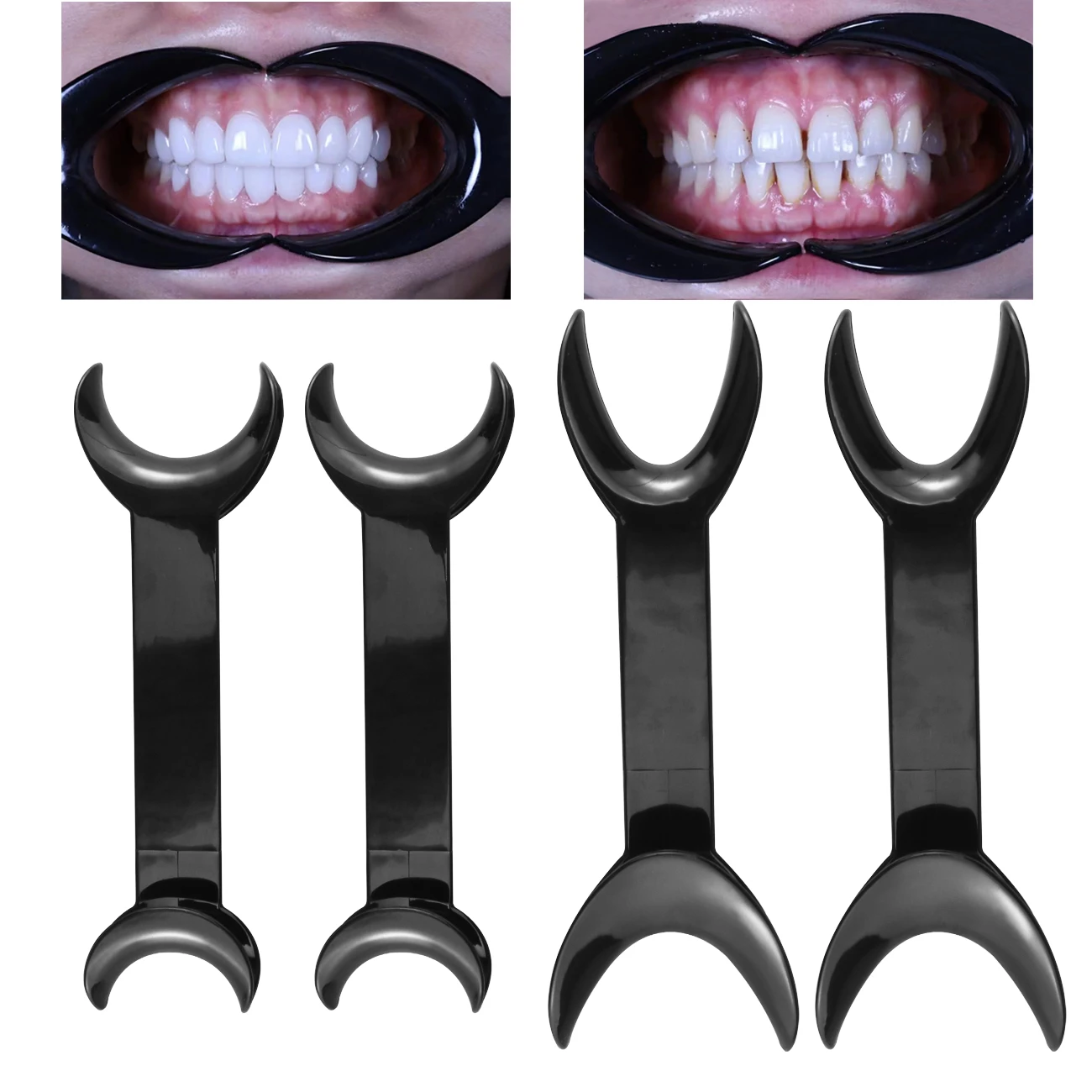 Doubleheaded Shape Intraoral Cheek Lip Retractor Opener Large And