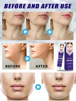 Remove double chin 4