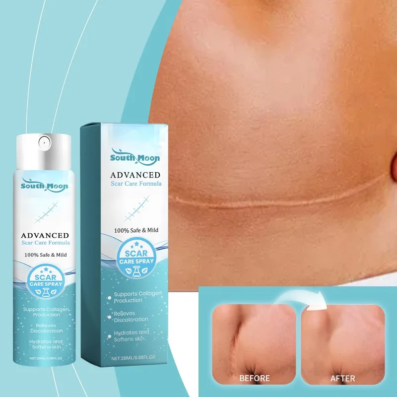 Skin Care Spray Mild Formula Repairing Moisturizes Fades Fine Lines Removal Stretch Marks Whiten Pigmentation Skin Spray whitening cream