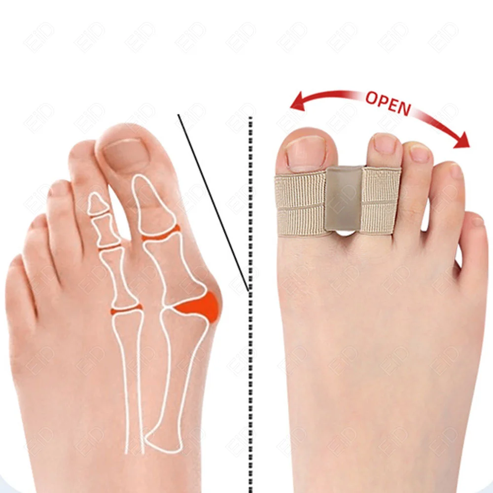 Silikon-Finger-Zehenspreizer, Schutz, Orthesenpolster, 2 Löcher, Bahren, Glätteisen, Bunion-Schutz, Schmerzlinderung, Fußpflege – Detail 12