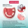 Multiple Types Dental Model Teeth Dental Teaching Models Study Orthodontic Removable Teeth Implant Models Dentist Material 5