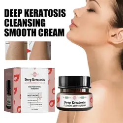 Chicken Skin Repair Cream Curing Body Dark Spot Keratosis Follicle Pilaris Remove Thick Pore Moisturizing Smooth Essence Lotion