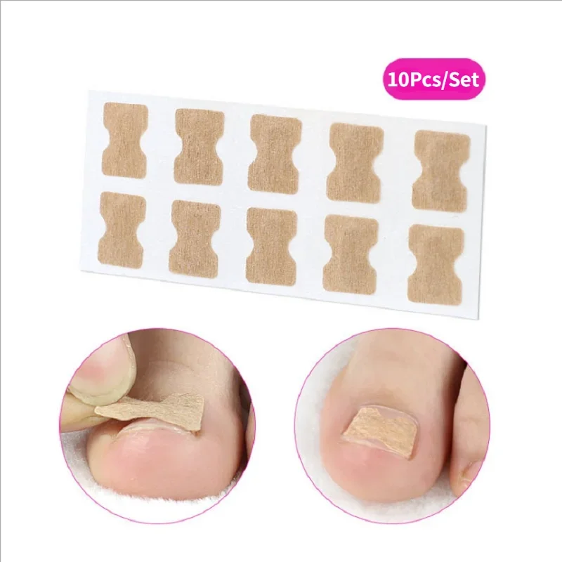 Nail Correction Stickers Ingrown Toenail Corrector Patches Paronychia Treatment Recover Corrector Pedicure Tools 20/50/100pcs ingrown toenail correction tool
