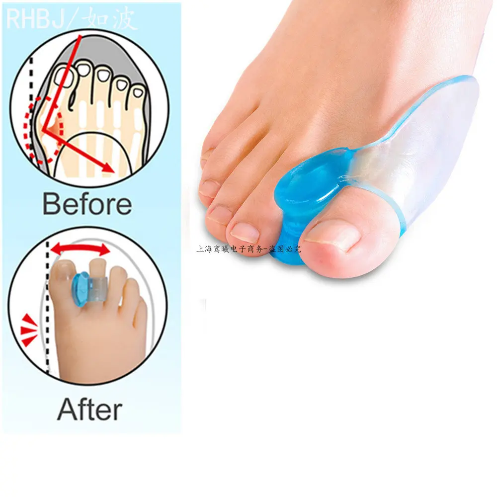 Silicone Gel 2pcs Thumb Corrector Bunion Little Toe Protector Separator Hallux Valgus Finger Straightener Foot Care Relief Pads 2pcs toe finger straightener hammer toe tape hallux valgus corrector bandage toe separator splint wraps foot care supplies new