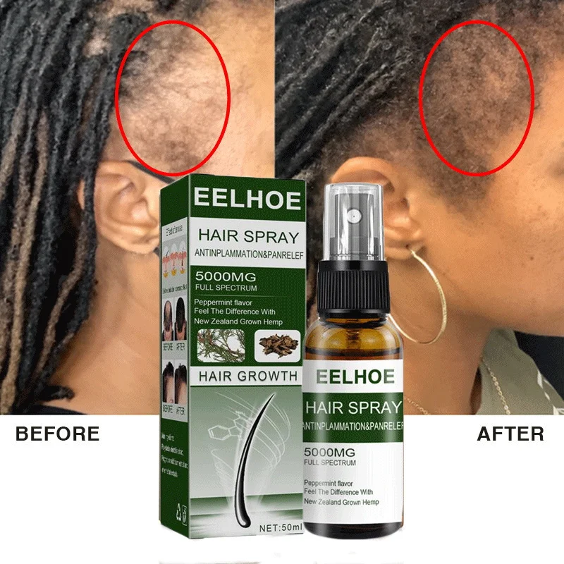 Ginger Essential Hair Growth Oil Natural Anti Hair Loss Product Damaged