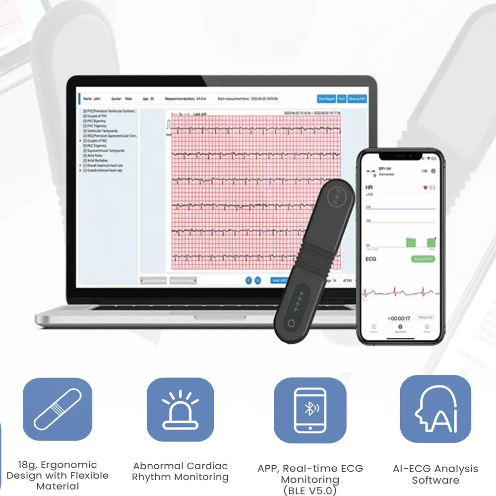 24 Hours Holter ECG,Wearable Bluetooth ECG, EKG,AI-ECG Analysis,Real-time Dynamic ECG Monito,Digital OLED Display