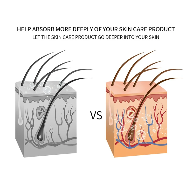 Mesotherapy Electroporation RF Radio Frequency Facial LED Photon Skin Care Beauty Device Face Lifting Tighten Wrinkle Removal