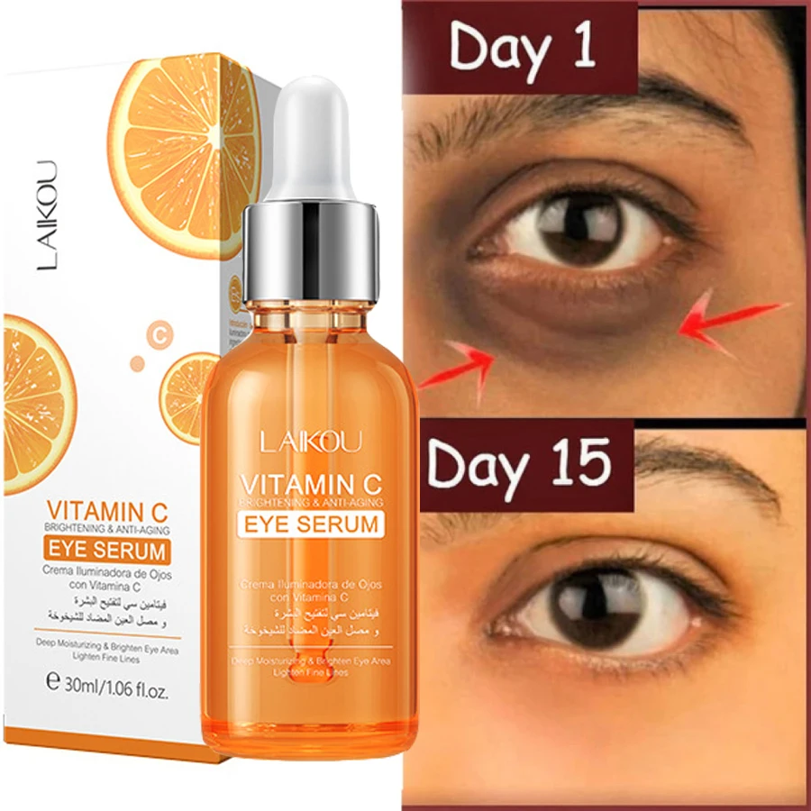 Vitamin C Remove Dark Circles Eye Serum Anti-Wrinkle Fade Fine Line Anti Eye Bag Puffiness Essence Anti-Aging Lift Firm Eye Care