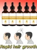 Transform Your Thin Hair into a Voluminous Mane 1