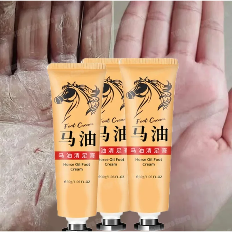 Advanced Repair Hand Cream For Dry Cracked Hands Luxury Moisturizing Nourishing Repairing Natural Lotion Horse Oil Skin Cream