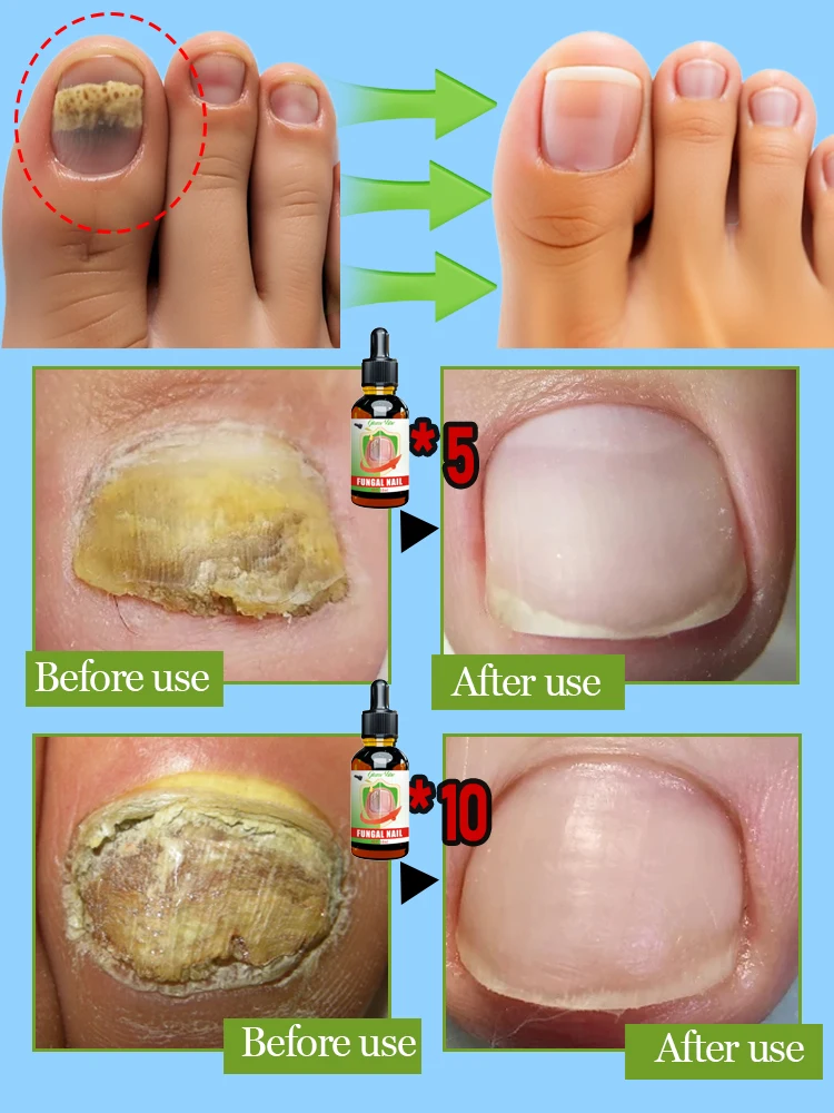 Foot Serum with Organic Essential Oil 7-Day Repair organic essential oil