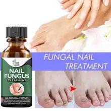 

10ml Nail Repair Liquid Fast Absorption Nourishing Mild Ingredients Feet Care Whitening Anti Infection Fungus Essence for Adult