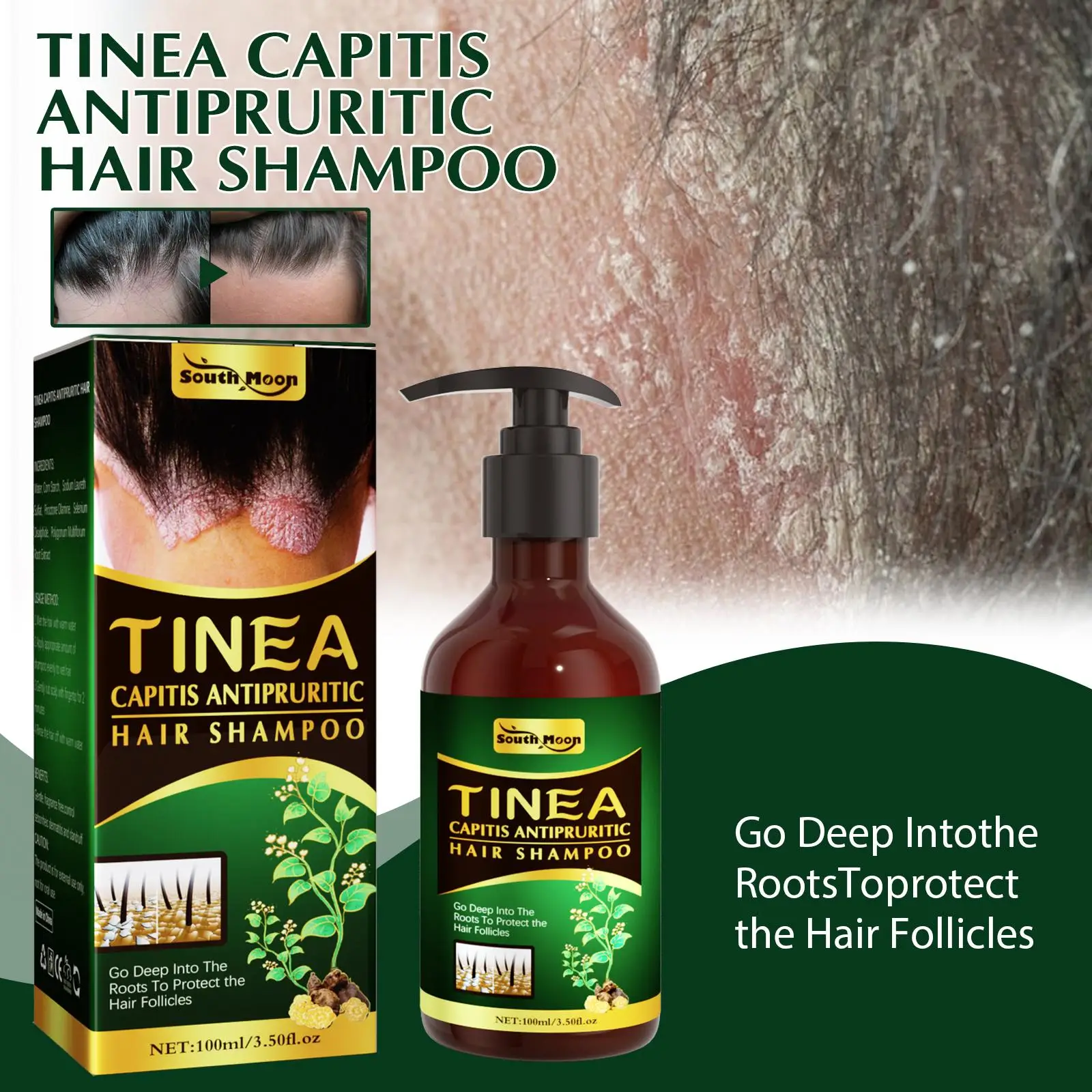 

100ml Shampoo Therapeutic Shampoo Anti-Dandruff Treatment Serie Itching Psoriasis Dermatitis Flaking Scalp Hair Care Seborr O1Q2