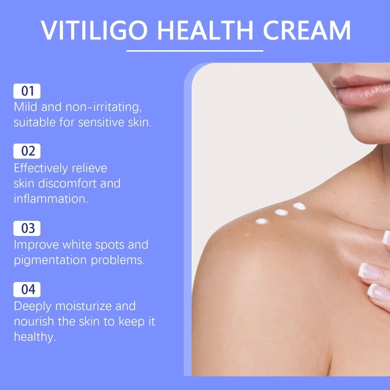 Vitiligo Treatment Cream Melanin Growth Cream Remove White Spot Eliminate Vitiligo Antibacterial Body Skin Care vitiligo ointment