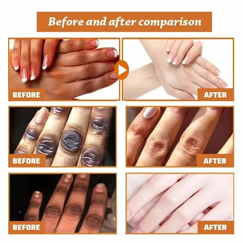 Dark Knuckles Fast Brighten Serum Elbows Hand Knuckle Brightening Serum Knee Black Skin Quickly Lighten Stains Remover Essence 2