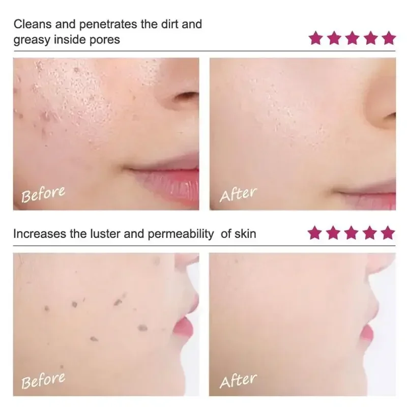 Face Exfoliating Cream Deep Exfoliator Gel Moisturizer Mango Repair Facial Scrub Cleaner Whiteing Brighten Face Skin Care facial exfoliant