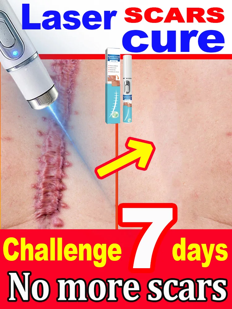 Laser scar repair 2
