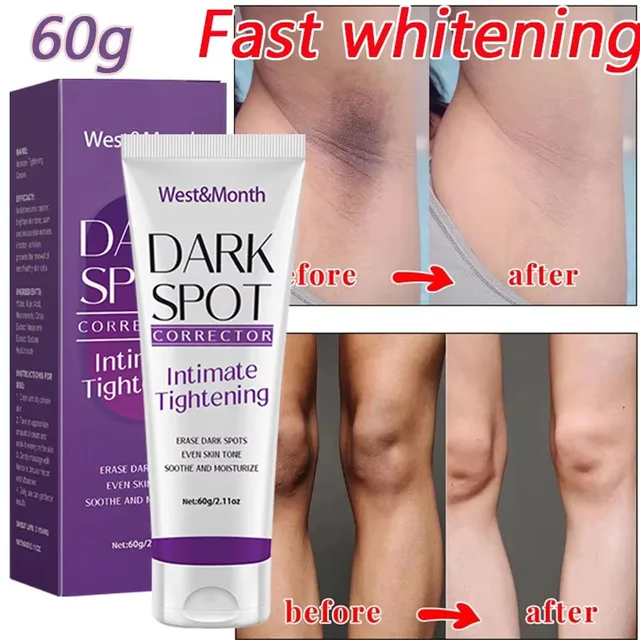 Body Whitening Lotion Dark Spot Remover For Underarms Knees Elbows Melanin Bleaching Lightening Skin Moisturizing Cream 60g