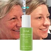 Noni Fruit Essence Noni Extract Energy Ampoule Face Serum Korean Anti-wrinkle Moisturizing Sooth Wrinkle Fine Line For All Skin 1