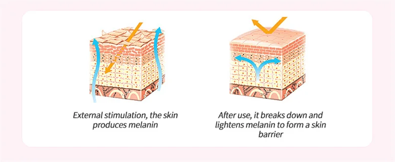 S18d7afafb5764949a5232b9399ff88c35 Intimate Area Whitening Cream Pink Body Serum Lighten Melanin Underarms Hips Inner Thighs Brightening Repair Private Part Care