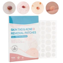 

108Pcs / Box Disposable Transparent Acne Sticker Skin Tag Removal Patch Wart Removal Sticker For Face Finger Arm Leg Beauty Tool