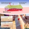 CEEPORT Medical 1x8in 50pcs Xeroform Petrolatum Dressing Non-Adherent Gauze Pad Strip for Wound Care 6