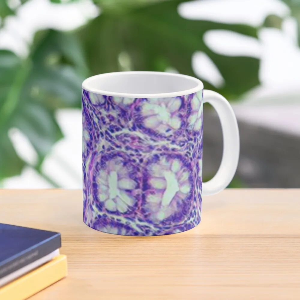 

Lieberkhun - colon Coffee Mug Custom Cups Cups Set Mug