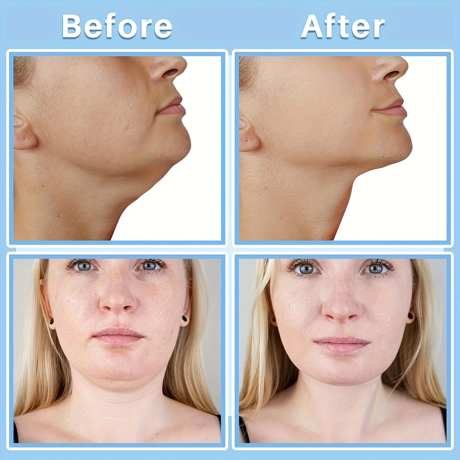 Invisible Neck Lifting Patch PU Film Skin Care Tool