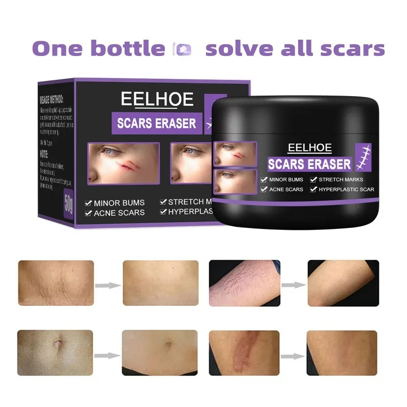 Scar Removal Cream Repair Stretch Marks Burn Surgical fade Acne old Scars Treatment Gel Whitening Beauty skin Health Care