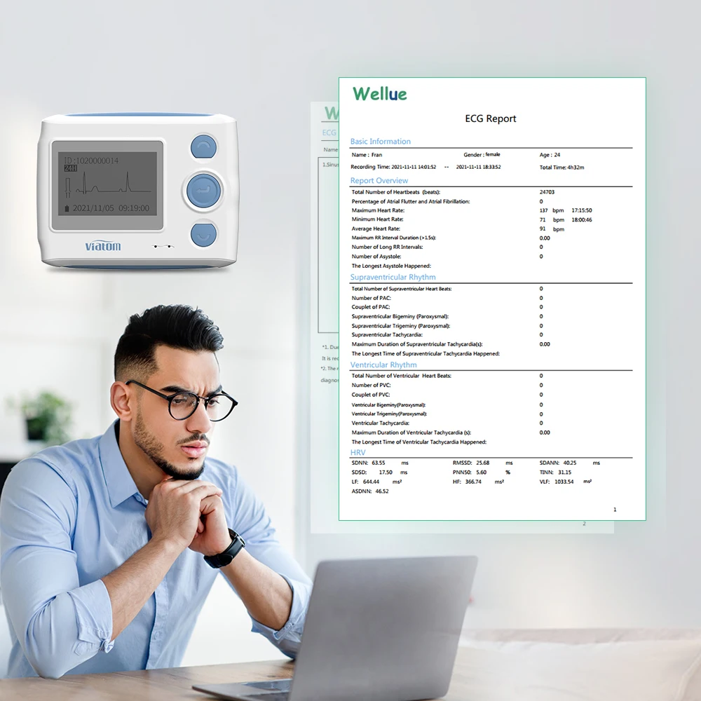 12 lead Holter monitor monitor recorder 24-hour continuous monitoring ECG and heart rate device ECG electrode data stora