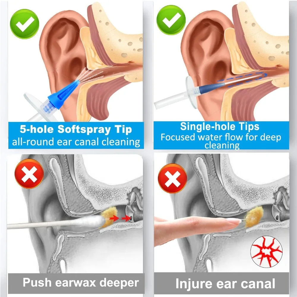 Ear Wax Removal Tool Manual Ear Irrigation Flushing System Safe and Effective Ear Cleaner for Adults Kids Cleaning Washer Kit - 4
