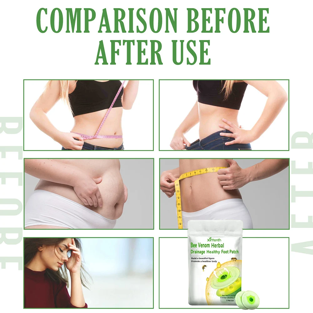 7/10pcs Bee Venom Lymphatic Drainage Slimming Patch Improve Stomach Lose Weight Detox Sticker Slimming Patch for Women and Men