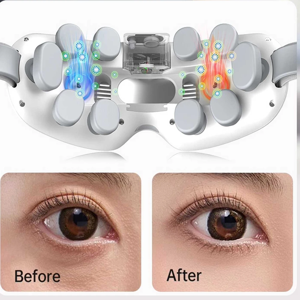 Eye Massager for Migraines Vibrating Hot&Cold Mist Eye Acupoint Massage Mask Relieve Stress Eye Care Device for Improve Sleep