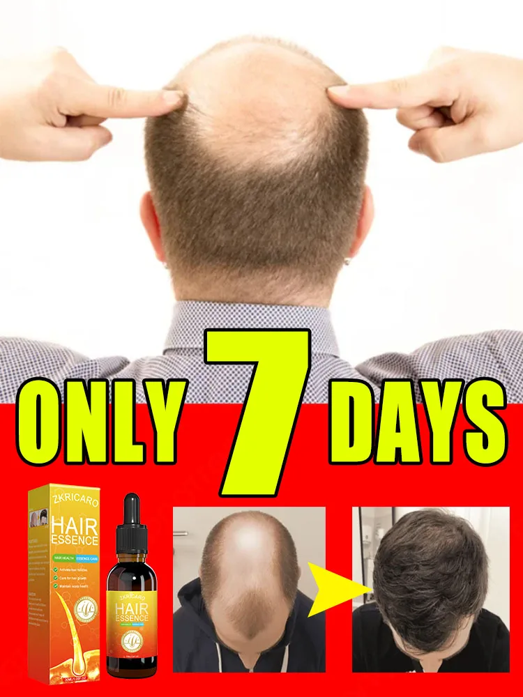 

Антиalopecia, масло для быстрого роста волос, Имбирная сыворотка