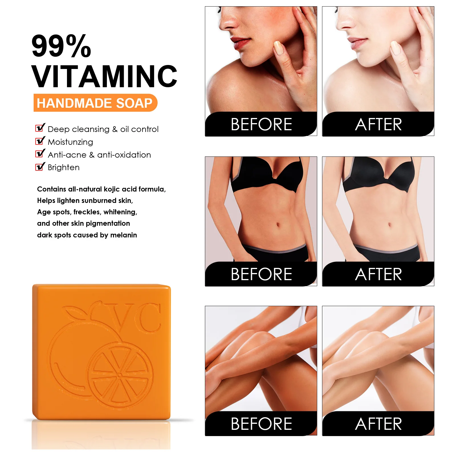 Skin Whitening Soap Dark Spot Remover Improve Dull Melanin Correcting Deep Cleaning Moisturizing Underarm Knees Brightening Soap
