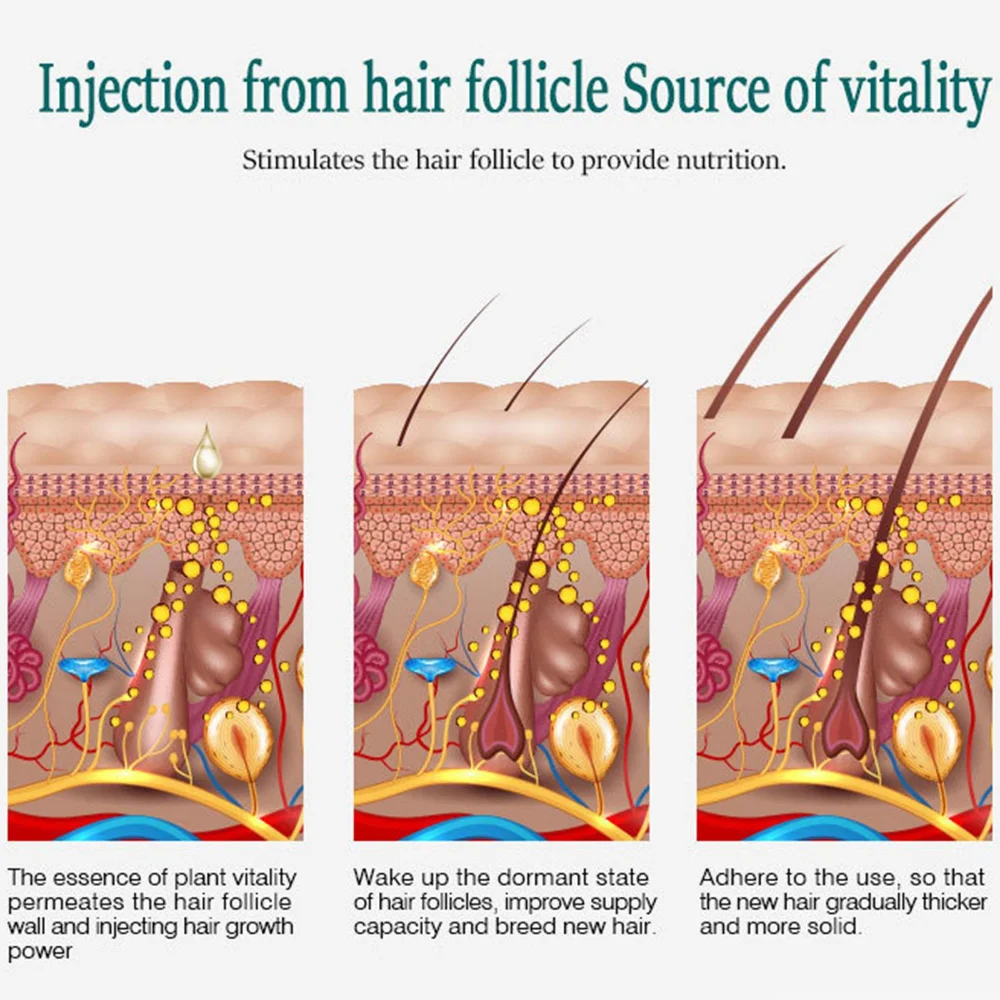 Hair Growth Essential Oil Biotin Cold-Pressed DHT Blocker Hair Growth Shampoo Anti-Hair Loss Conditioner Accessories hair growth serum hair growth spray hair care oil hair growth cream hair growth shampoo set