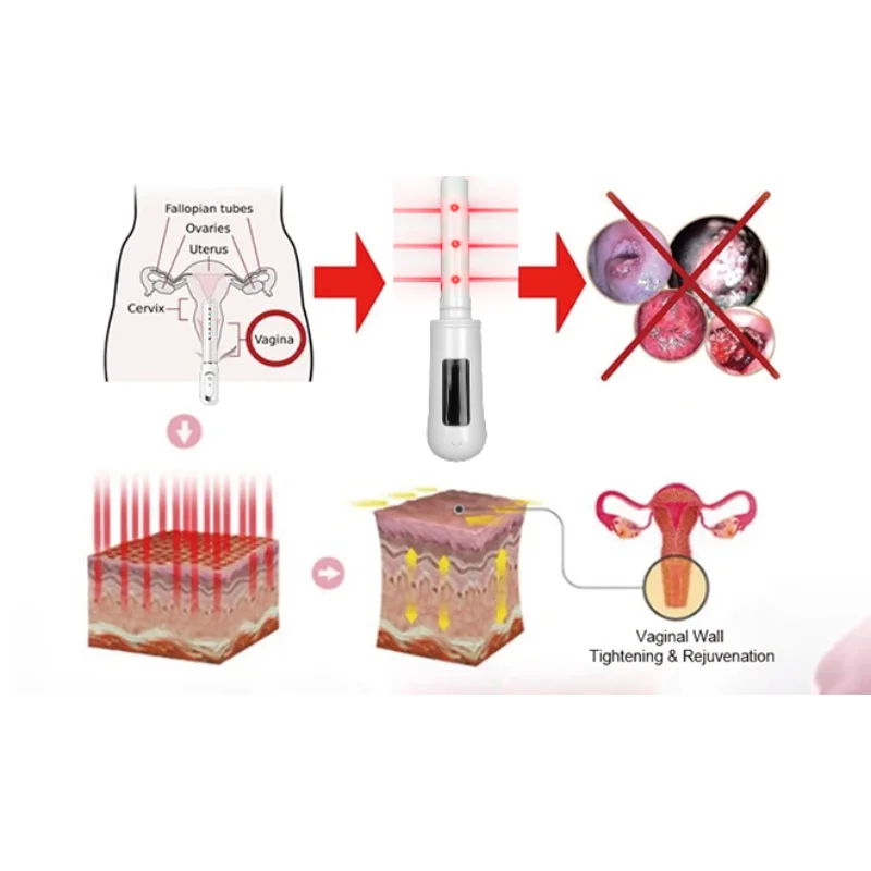 Rus tilida qora tanlilar bilan birinchi marta jinsiy aloqa