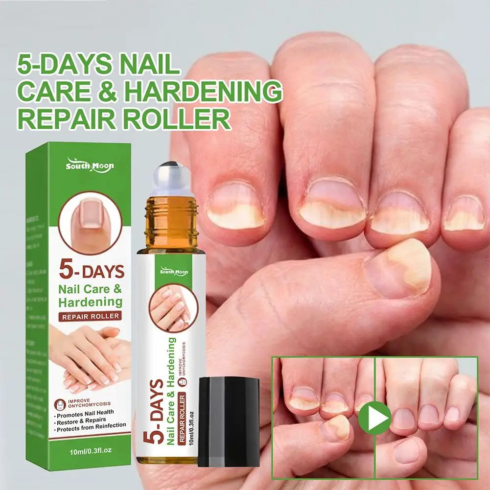 5 Days Nail Growth And Hardening Repair Roller Nail Repair Softening Removing Thickening Brightening Nutrient Solution nail growth solution