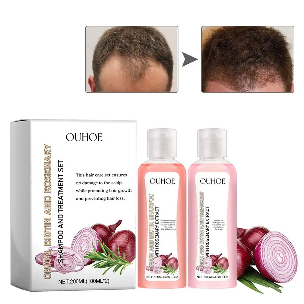 

200ml Onion Biotin And Rosemary Shampoo Set Deep Clean Scalp The Hair Care Loss Ati Hair Strands Hair Stronger And Z8J4