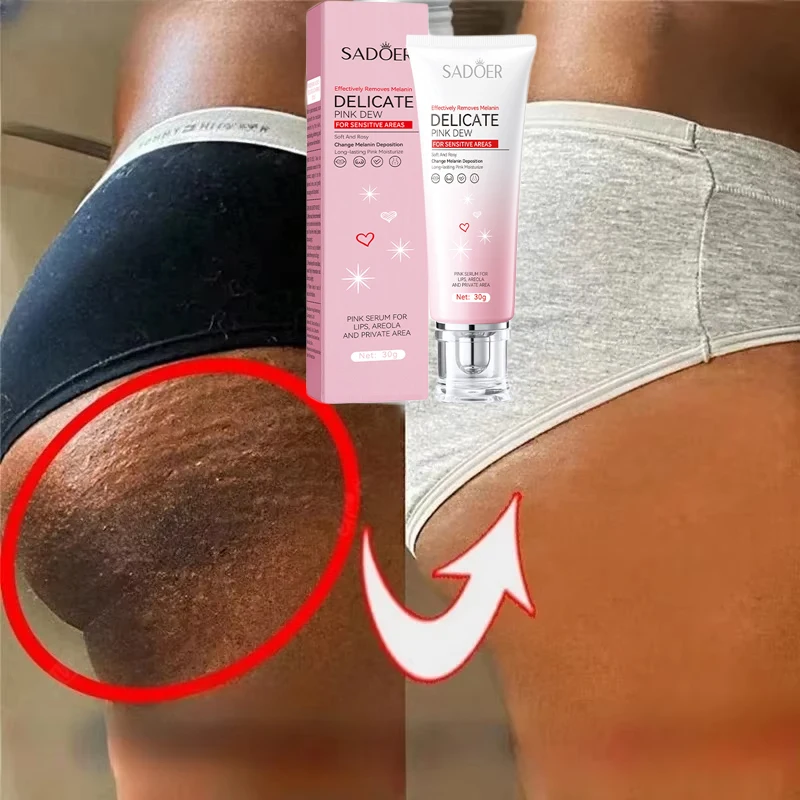 Nicotinamide Brightening Cream For Dark Skin Effective Lighten Thigh Inner Bleach Remove Melanin Private Parts Brighten Cream 3