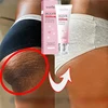 Nicotinamide Brightening Cream For Dark Skin Effective Lighten Thigh Inner Bleach Remove Melanin Private Parts Brighten Cream 3