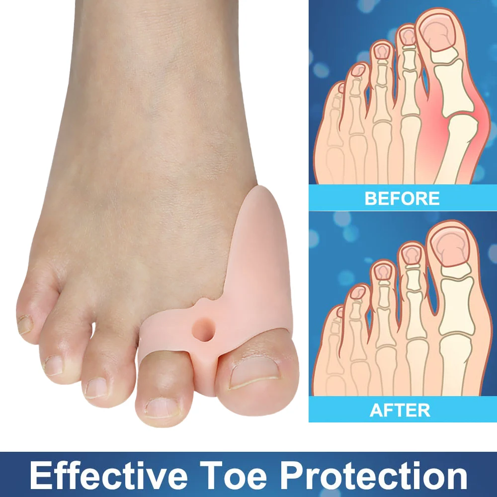 Pexmen 2Pcs/Pair Soft Bunion Corrector Toe Separators Spacers for Bunion Relief Bunion Cushion Protector with Gel Shield 2