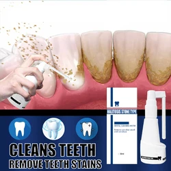 Dental Calculus Dissolving Spray Bacteria Deodorizing Dental Calculus Lasting and Refreshing Whitening Care Tool 30g