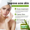 Aloe Brightening Soap Bar, Reduce Dark Spots, Sun Spots, Acne, Oil Control, Clean Stains, Exfoliation, For Face and Body 3