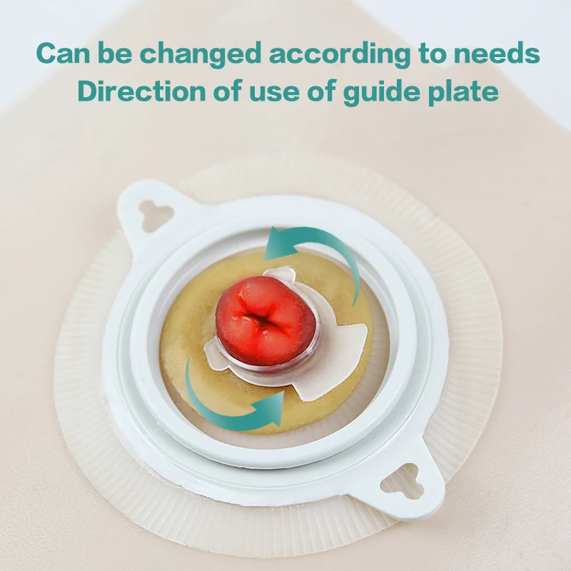 Anti-Leakage Ring For Colostomy Bag Ostomy Paste Ring Base Plates Stoma Care Products To Protect Skin