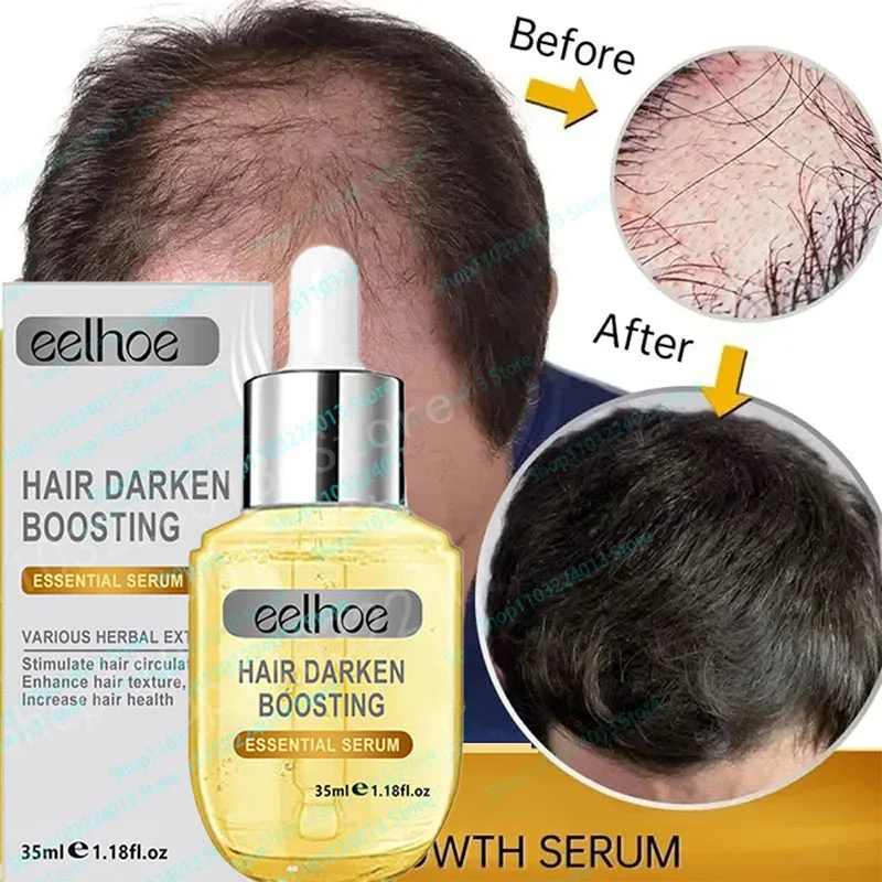 

Natural Hair Growth Oil Efficient Anti Hair Loss Nourishing Essential Oil For Dense Repair Damaged Hair Moisturizing Smooth Oil
