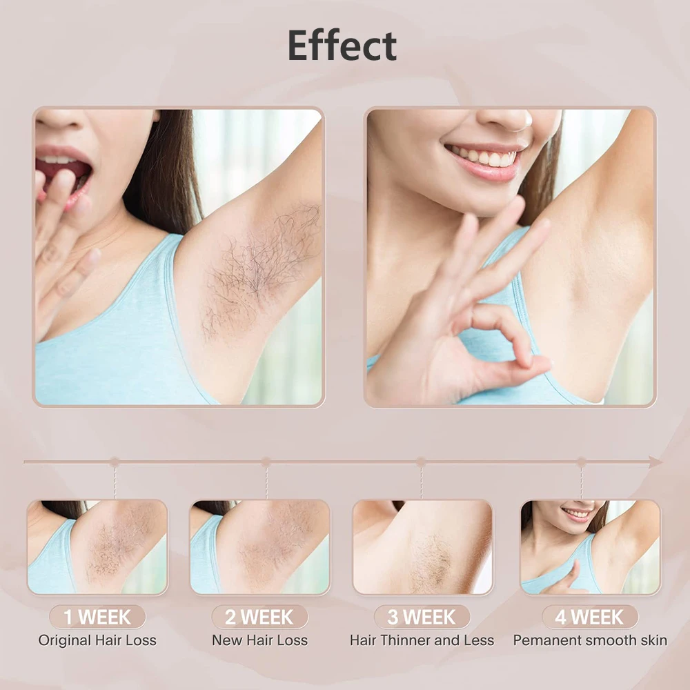 Ipl Laser Epilierer Für Damen Zur Dauerhaften Haarentfernung_voghion.com