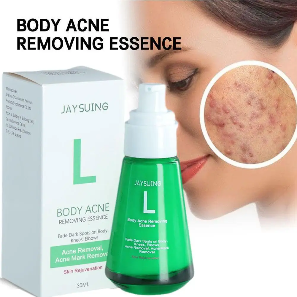 

Buttock Acne Removing Serum Body Whitening Essence Fade Acne Dar Spots Remove Acne Marks Moisturize Skin Care Lotion